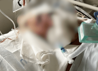 Brutalny atak w Grudziądzu. 63-latka ledwo przeżyła. Syn błaga o ratunek! atak w Grudziądzu